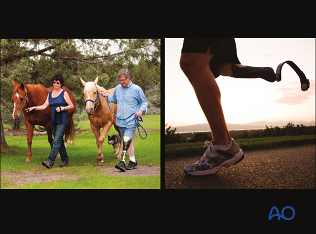 Appropriate primary amputation usually results in a wound which heals satisfactorily, effectively preventing infection.