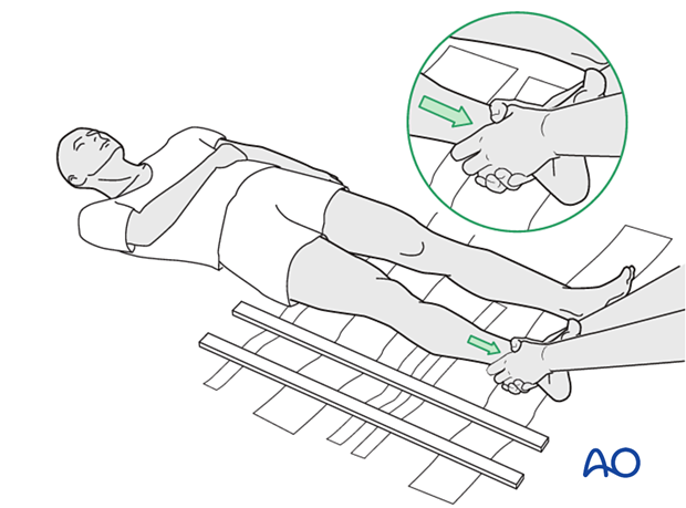 42_X110_i060 First aid for tibial fractures