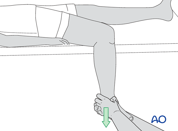 42_X110_i320 Tibial fracture reduction