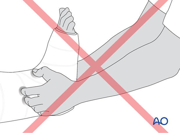 42_X110_i780 Cast application, mistakes to avoid