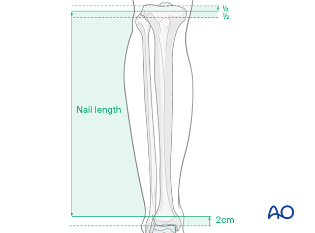 42_X120_i020 Determining nail length
