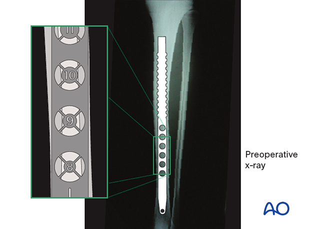 42_X120_i030 Determining nail diameter