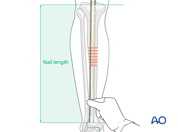 42_X120_i110 Determining nail length