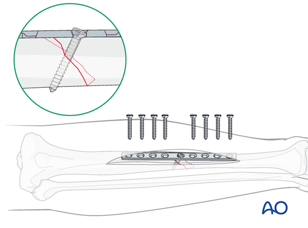 Plate selection and preparation