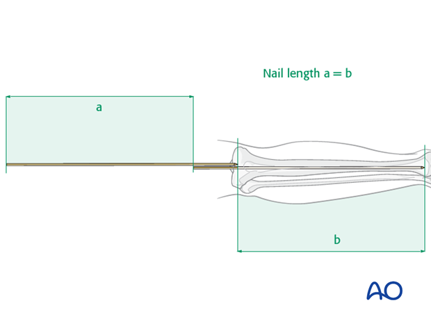 Nail length
