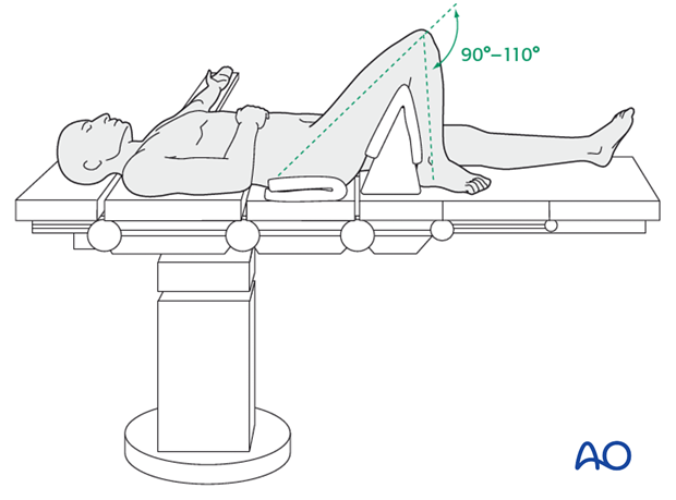 supine position for nailing