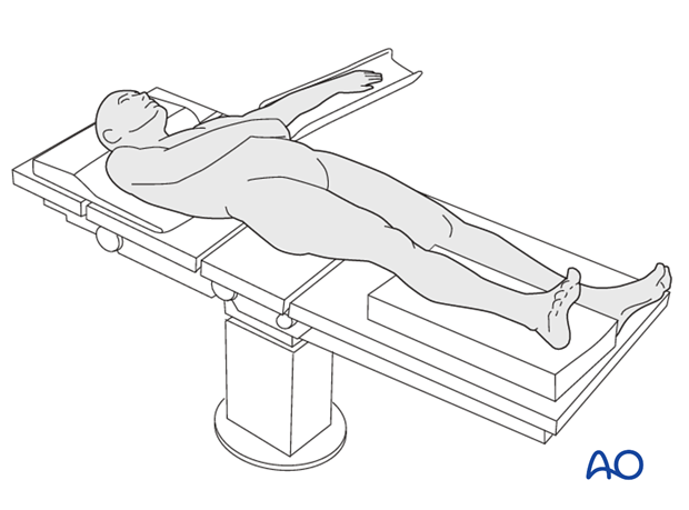 Patient positioning for lower leg casting