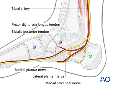 Temporary joint-bridging modular external fixation for Extraarticular ...