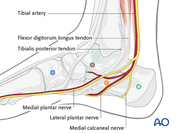 Pin placement in the foot for modular external fixation