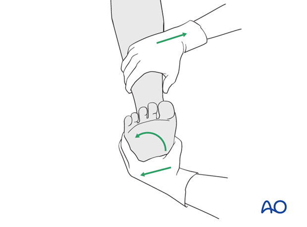 Stability check of the ankle mortise (syndesmotic ligaments)