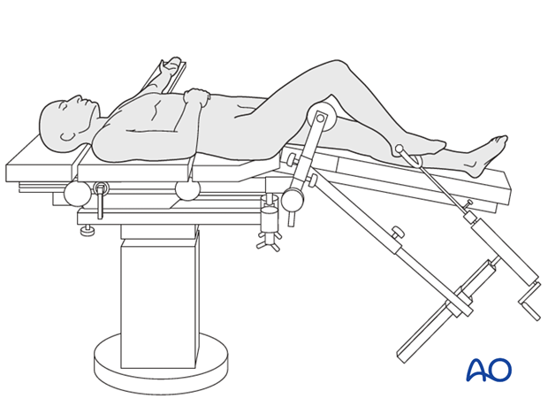 Supine position with knee flexed 90°