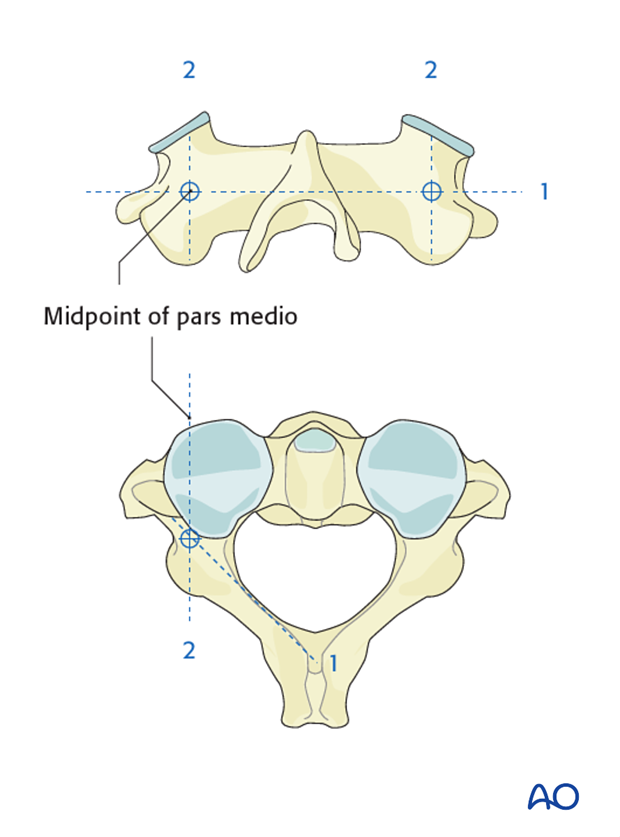 Identifying entry point for C2 pedicle screw
