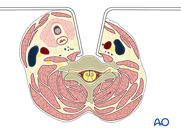 anterior approach to the cervical spine