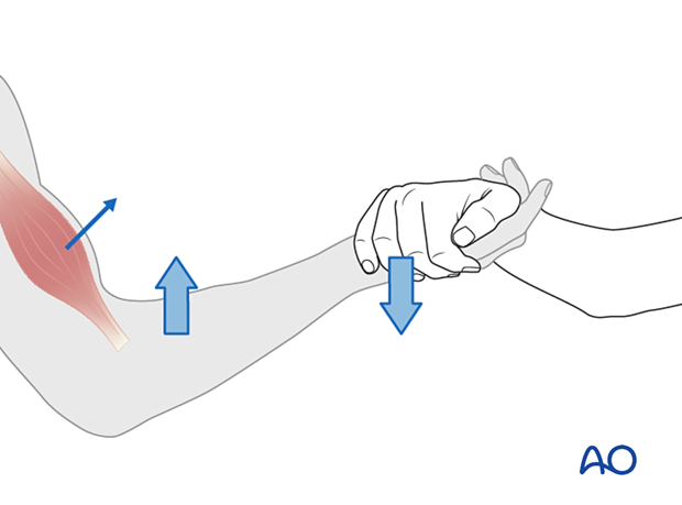 Manual Muscle Testing of elbow flexors (C5)