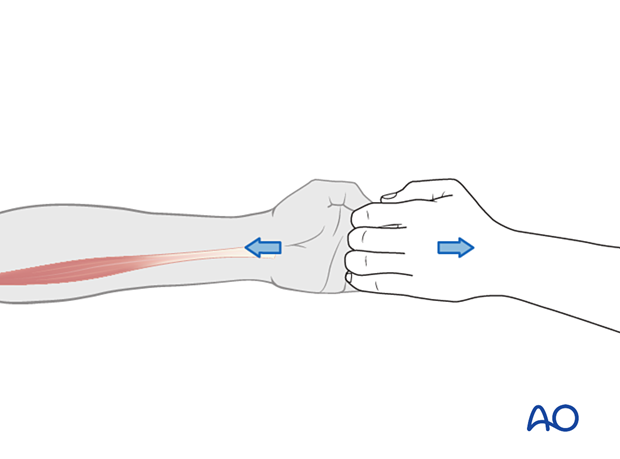 Manual Muscle Testing of finger flexors (C8)