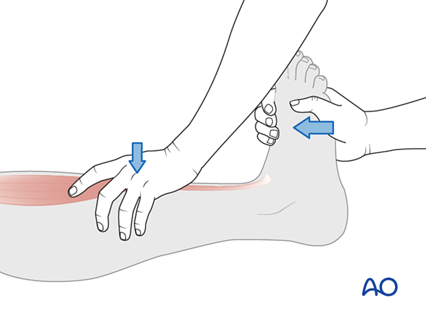 Manual Muscle Testing of ankle dorsiflexors (L4)