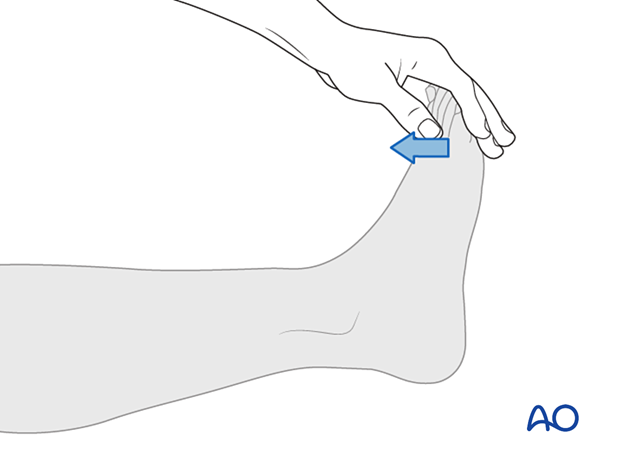 Manual Muscle Testing of great toe extensors (L5)