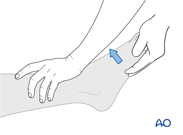 Manual Muscle Testing of ankle plantar flexors (S1)