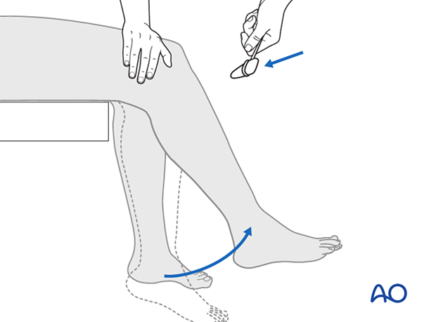 Reflex examination of knee tendon (L4)