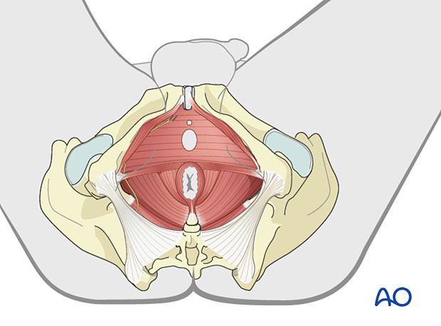 The anal sphincter allows for the most caudal assessment of motor innervation