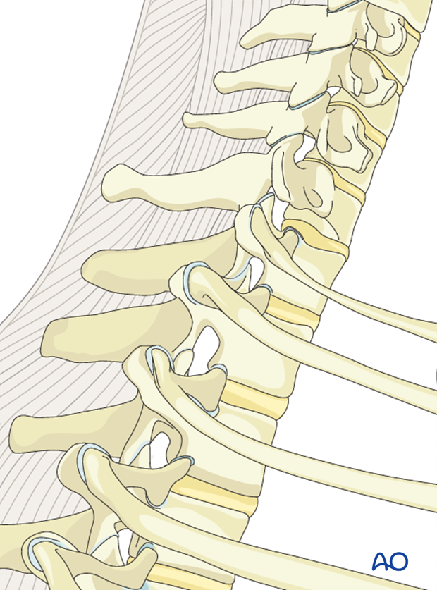 combined anterior and posterior 360