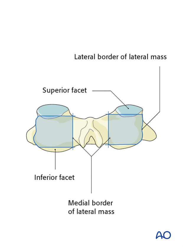 Anatomical landmarks identified during lateral mass screw insertion magerl technique