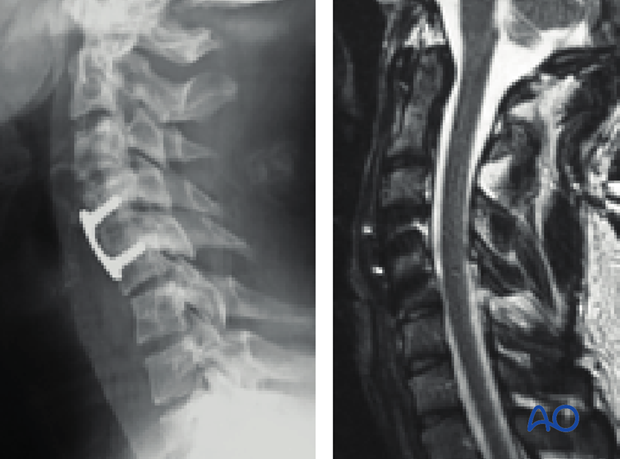 postoperative deformities