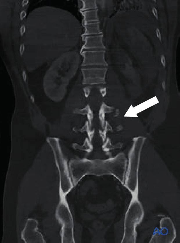 Patient Examination: Radiological evaluation (XR,CT, MRI)
