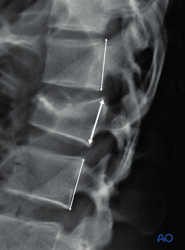 Patient Examination: Radiological evaluation (XR,CT, MRI)