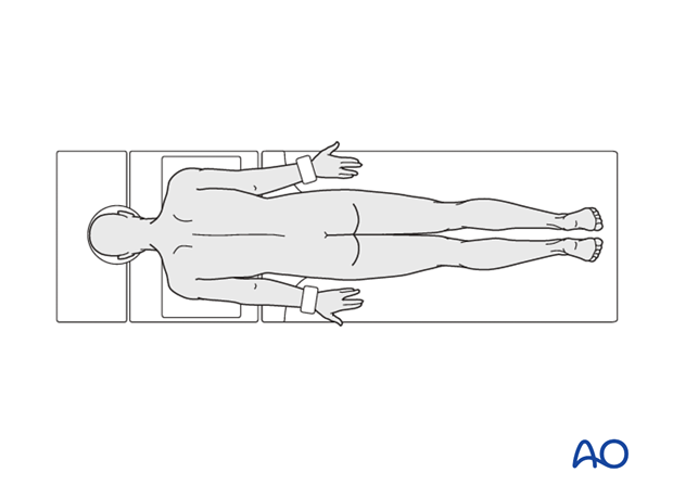 Patient positioned on a radiolucent table in prone position with arms adducted for surgery that extends above T8