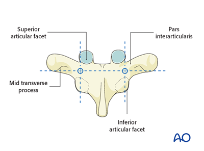 Pedicle screw insertion in the thoracolumbar spine