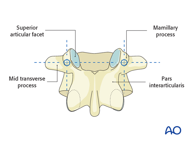 insertion of the pedicle screws