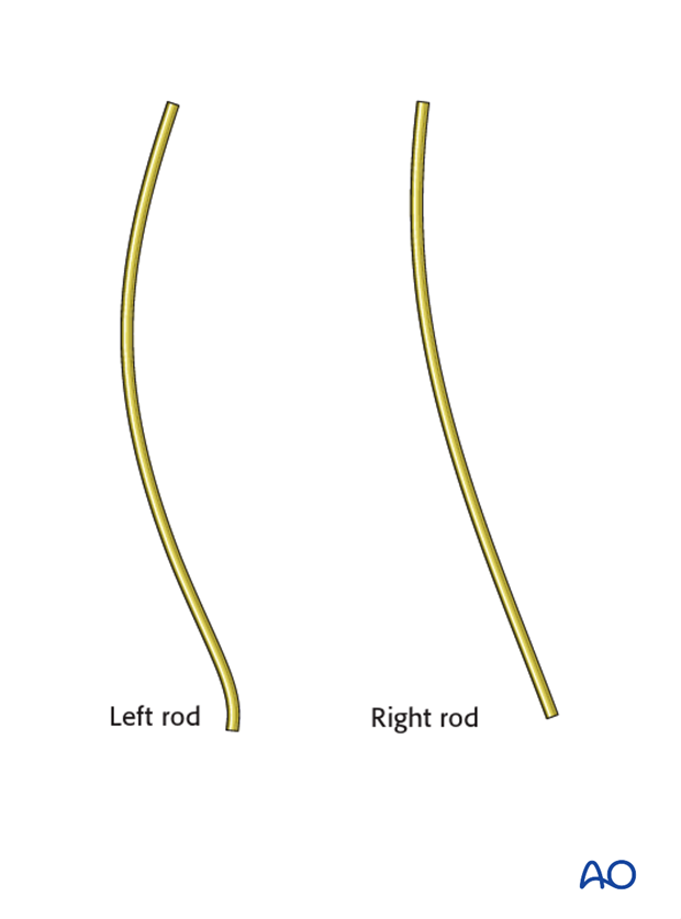 AIS Lenke 3 Posterior pedicle screws - Rod bending