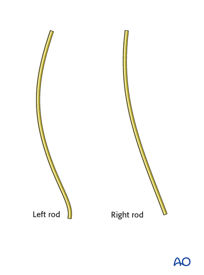 Posterior Screws - No direct vertebral body derotation for Lenke 3