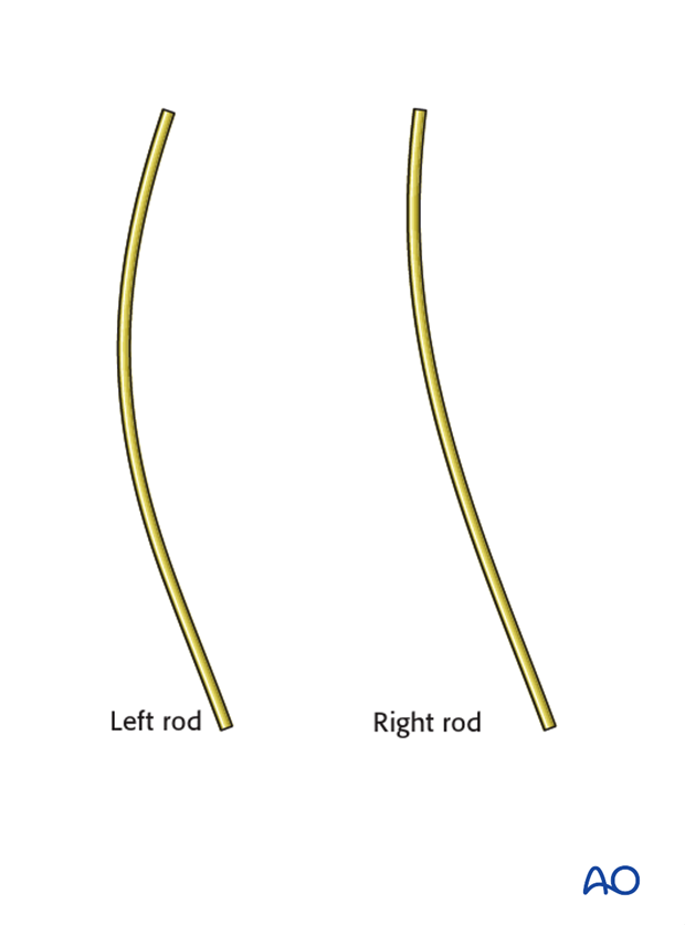 AIS Lenke 3 Posterior surgery - Right rod bending
