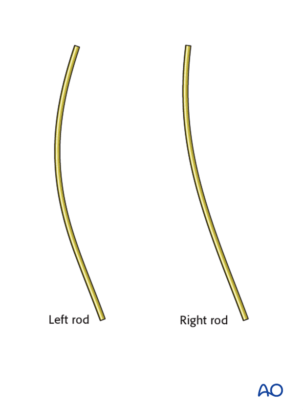 AIS Lenke 4 Posterior surgery - Rod bending