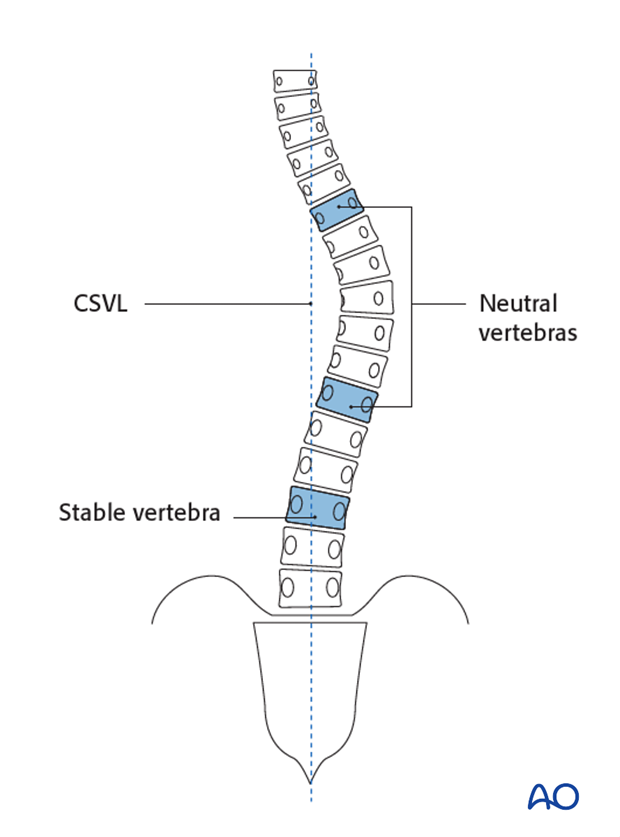 patient examination