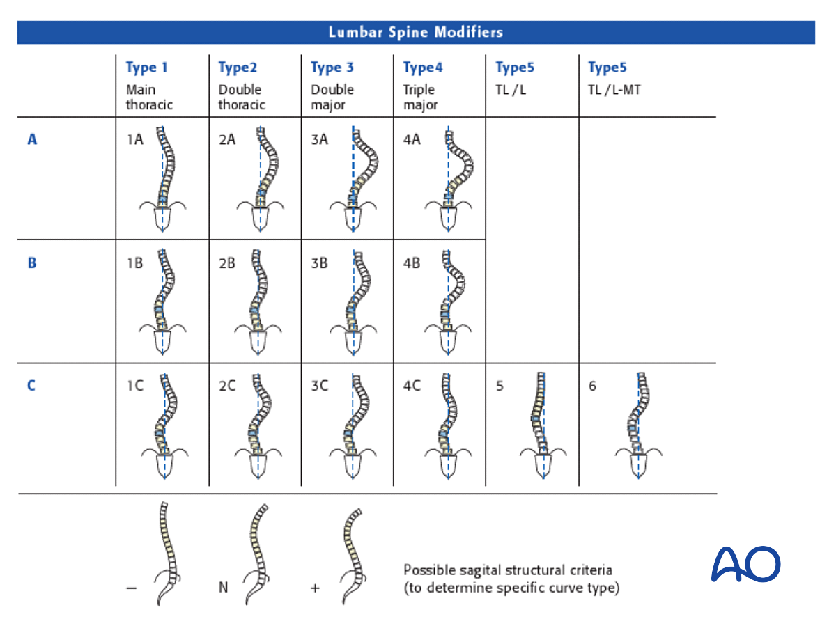 Lenke Classification