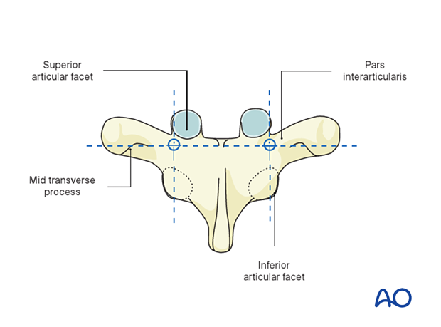 Landmarks for pedicle screw insertion in the thoracic spine