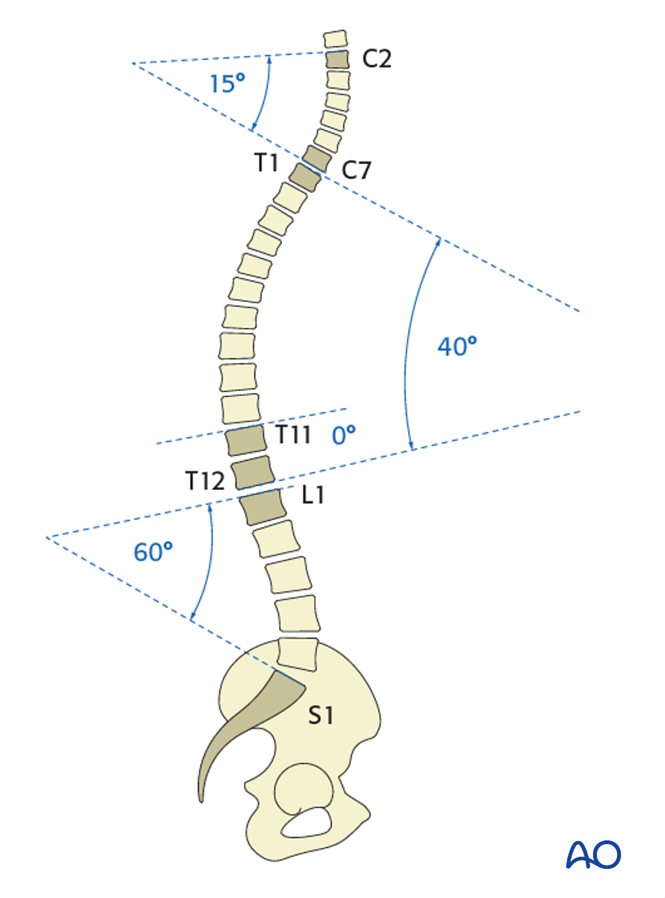 Sagittal spinal alignment