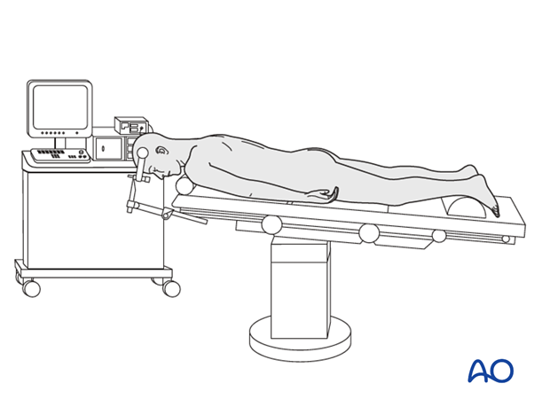 Spinal cord monitoring of patient in prone position