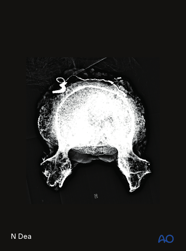 Axial view of the specimen