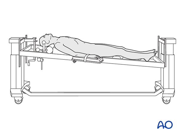 Patient positioned on a radiolucent table in supine position for approach to C3 to C7