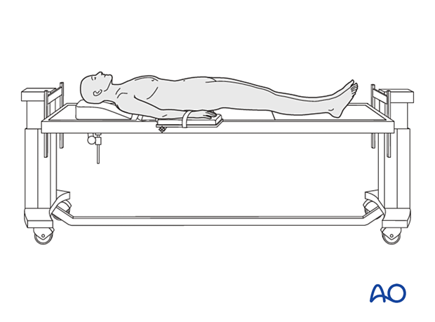 Patient positioned on a radiolucent table in supine position