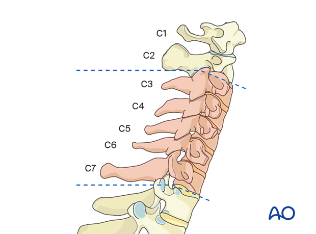 Cervical disc herniations occur in the subaxial region.