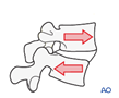 Lumbar
