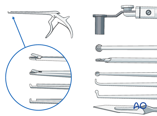 Recommended instruments for minimally invasive surgery on the lumbar spine.