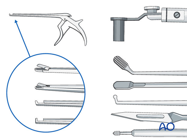 Recommended instruments for minimally invasive surgery on the lumbar spine