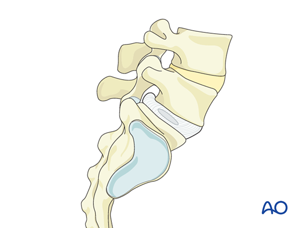 The distal part of the lumbar spine