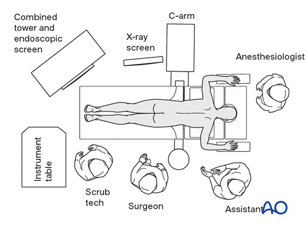 OR set up for endoscopic procedures.